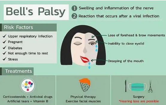 又出事了！4人接種輝瑞疫苗后面癱，還有人頭痛、發(fā)燒、關(guān)節(jié)疼痛！各國疫苗接種計劃面臨新風(fēng)險！